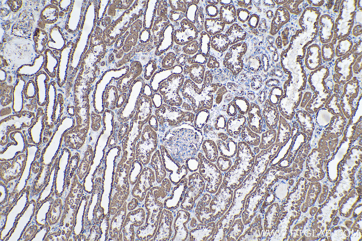 Immunohistochemical analysis of paraffin-embedded human kidney tissue slide using KHC0544 (ETFA IHC Kit).