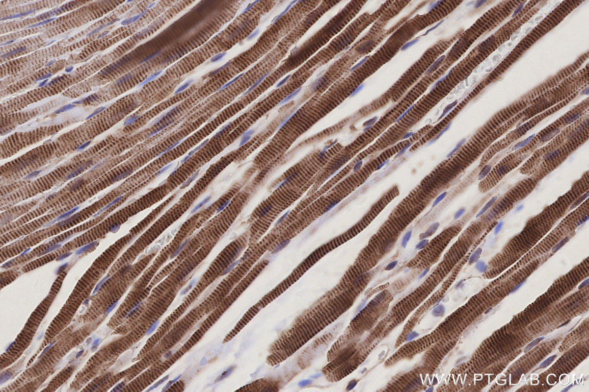 Immunohistochemical analysis of paraffin-embedded rat heart tissue slide using KHC3207 (ETFB IHC Kit). Immunohistochemical analysis of paraffin-embedded rat heart tissue slide using KHC3207 (ETFB IHC Kit).