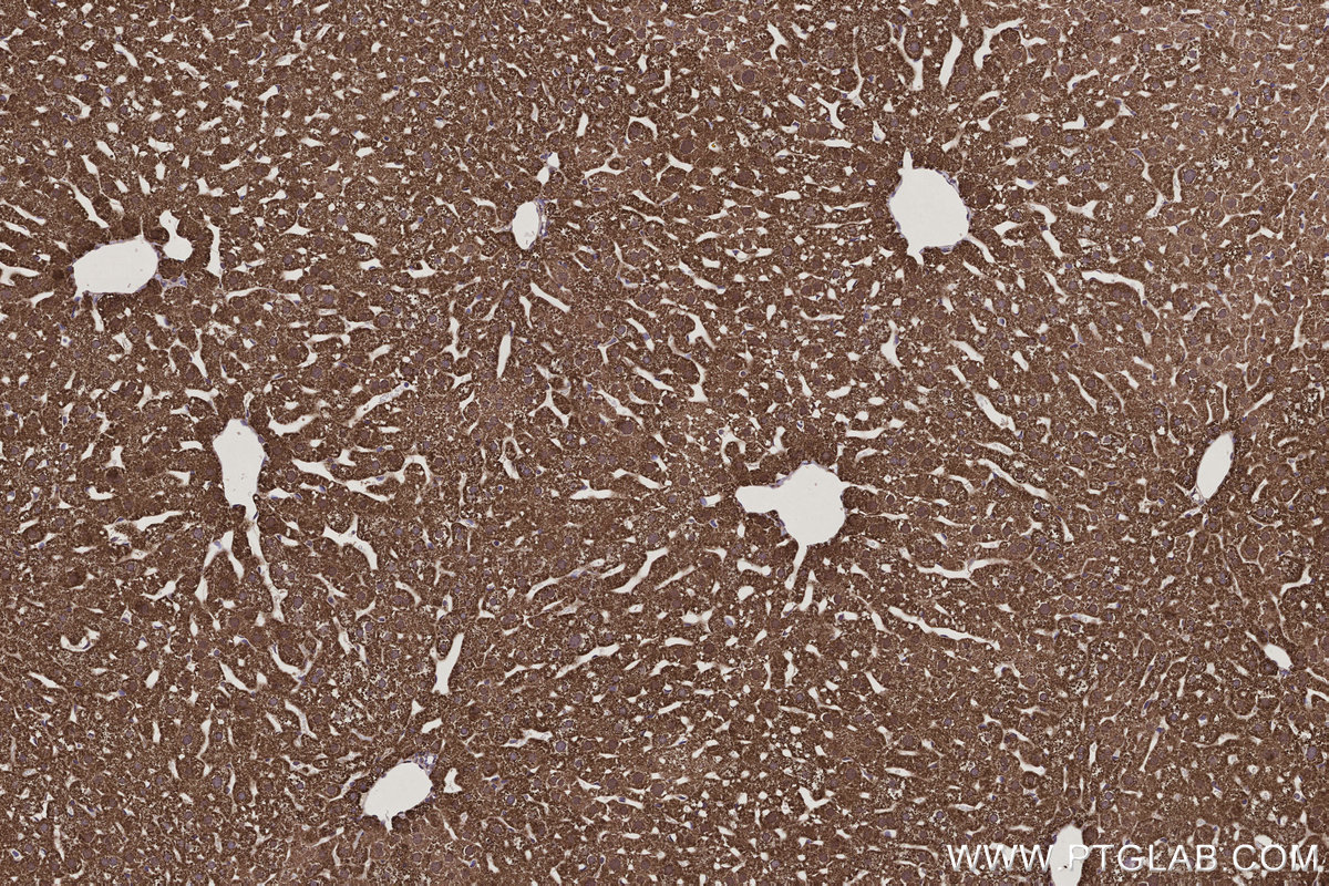 Immunohistochemical analysis of paraffin-embedded mouse liver tissue slide using KHC3207 (ETFB IHC Kit). Immunohistochemical analysis of paraffin-embedded mouse liver tissue slide using KHC3207 (ETFB IHC Kit).