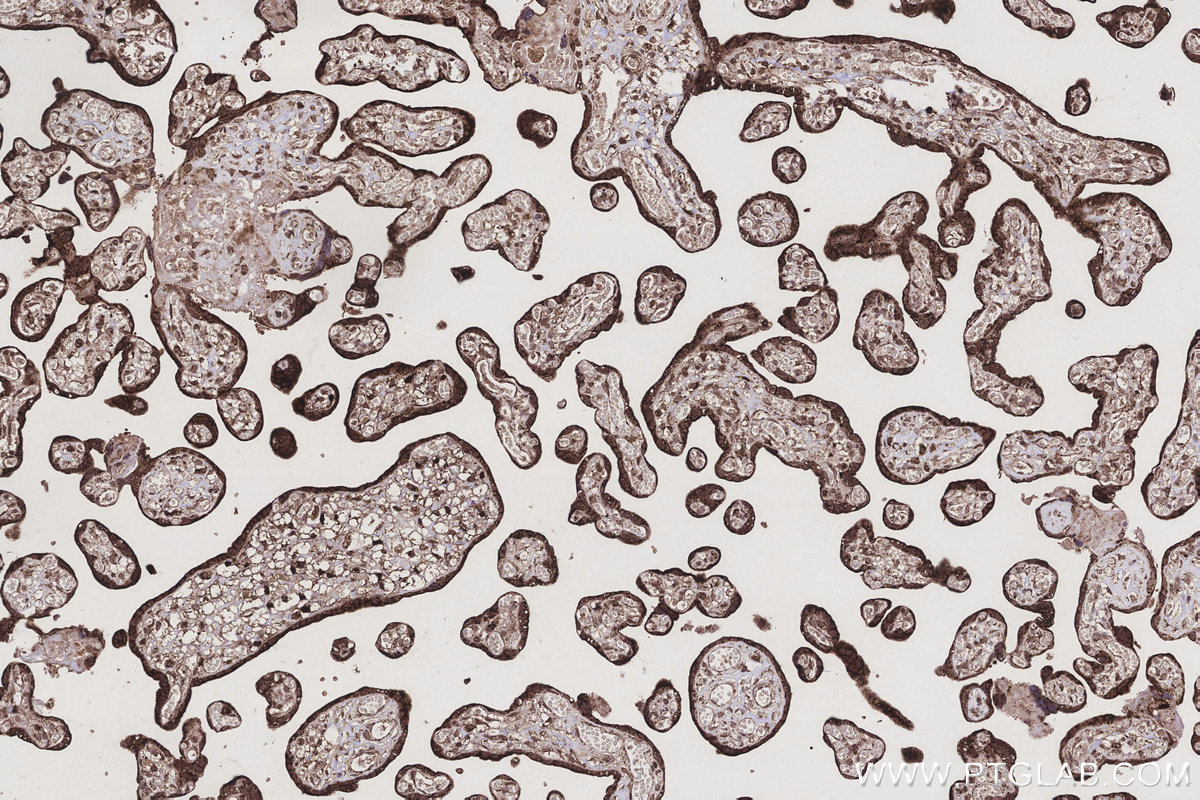 Immunohistochemical analysis of paraffin-embedded human placenta tissue slide using KHC3207 (ETFB IHC Kit). Immunohistochemical analysis of paraffin-embedded human placenta tissue slide using KHC3207 (ETFB IHC Kit).