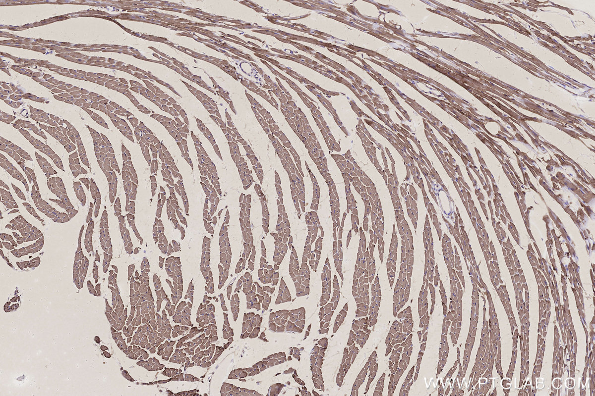 Immunohistochemical analysis of paraffin-embedded mouse heart tissue slide using KHC3207 (ETFB IHC Kit). Immunohistochemical analysis of paraffin-embedded mouse heart tissue slide using KHC3207 (ETFB IHC Kit).