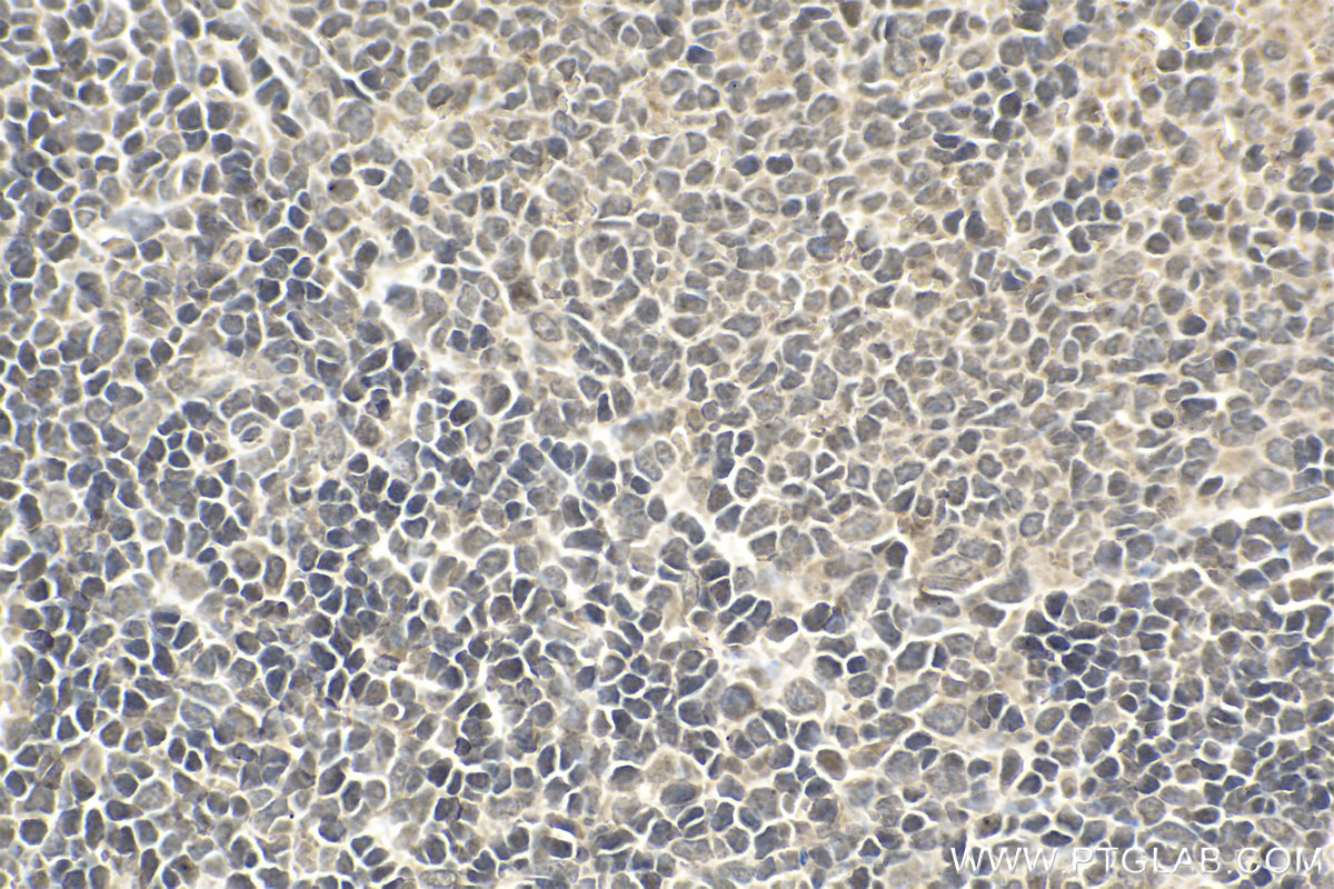 Immunohistochemical analysis of paraffin-embedded rat spleen tissue slide using KHC1534 (ETS2 IHC Kit).