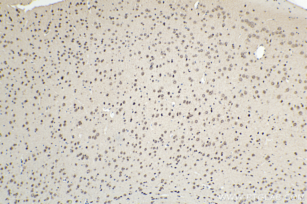 Immunohistochemical analysis of paraffin-embedded mouse brain tissue slide using KHC1606 (ETV5 IHC Kit).