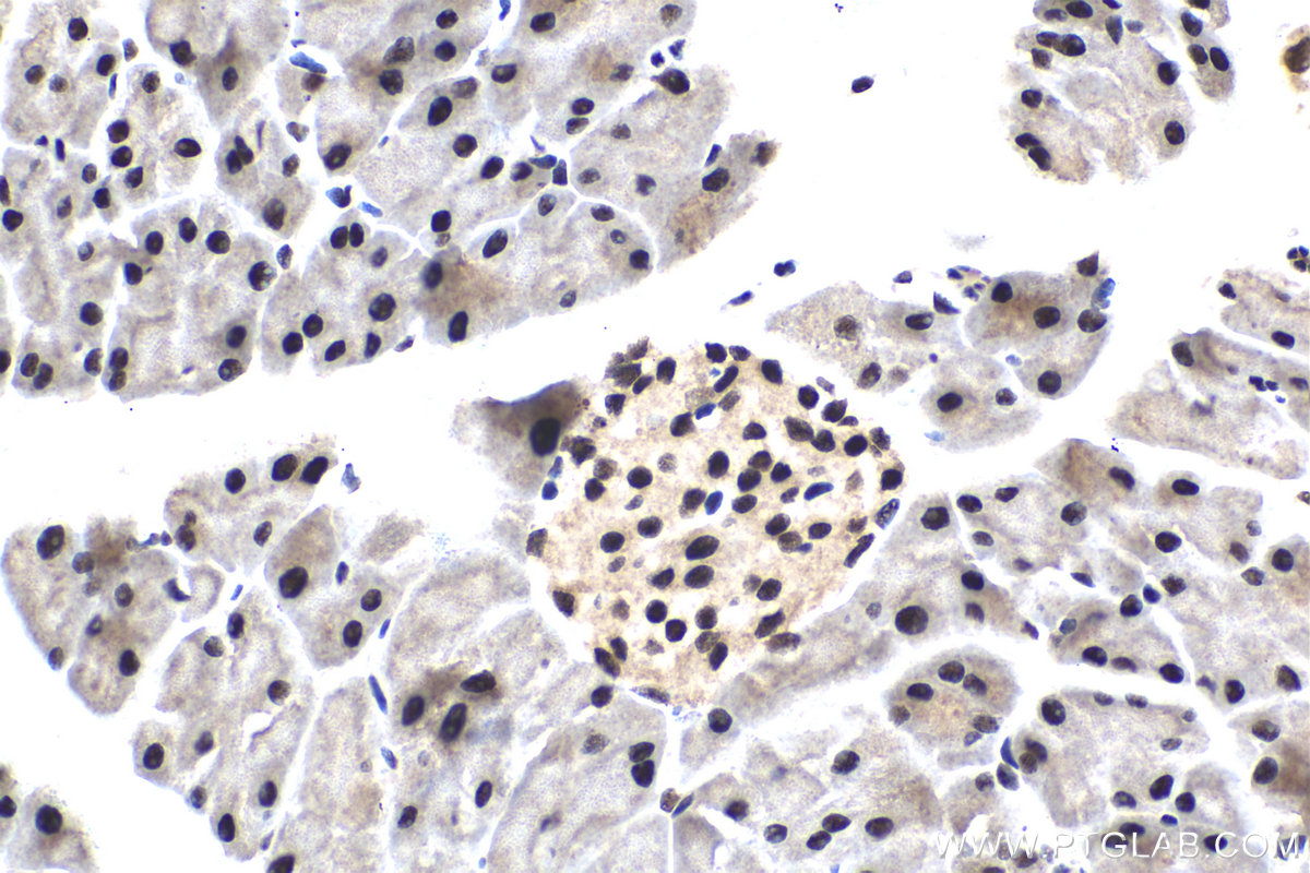 Immunohistochemical analysis of paraffin-embedded mouse pancreas tissue slide using KHC1606 (ETV5 IHC Kit).