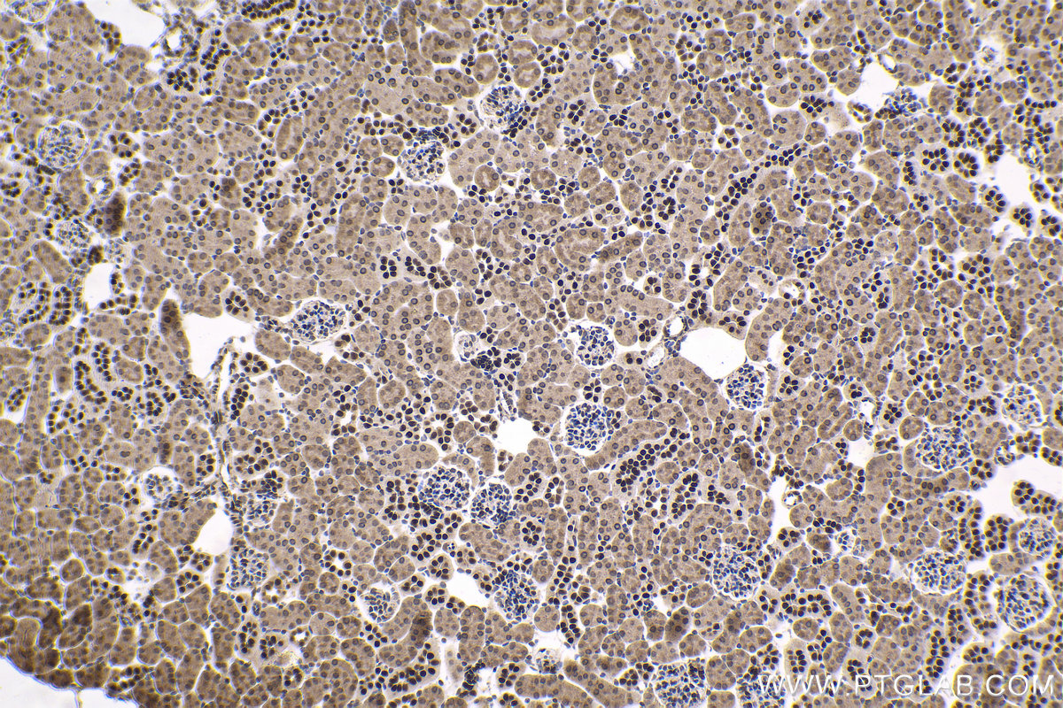 Immunohistochemical analysis of paraffin-embedded mouse kidney tissue slide using KHC1672 (EVI1 IHC Kit).