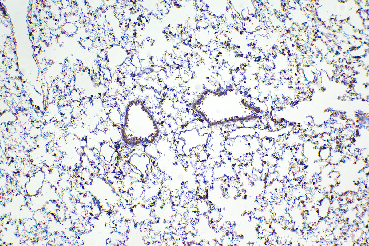Immunohistochemical analysis of paraffin-embedded rat lung tissue slide using KHC2242 (EVI2B IHC Kit).