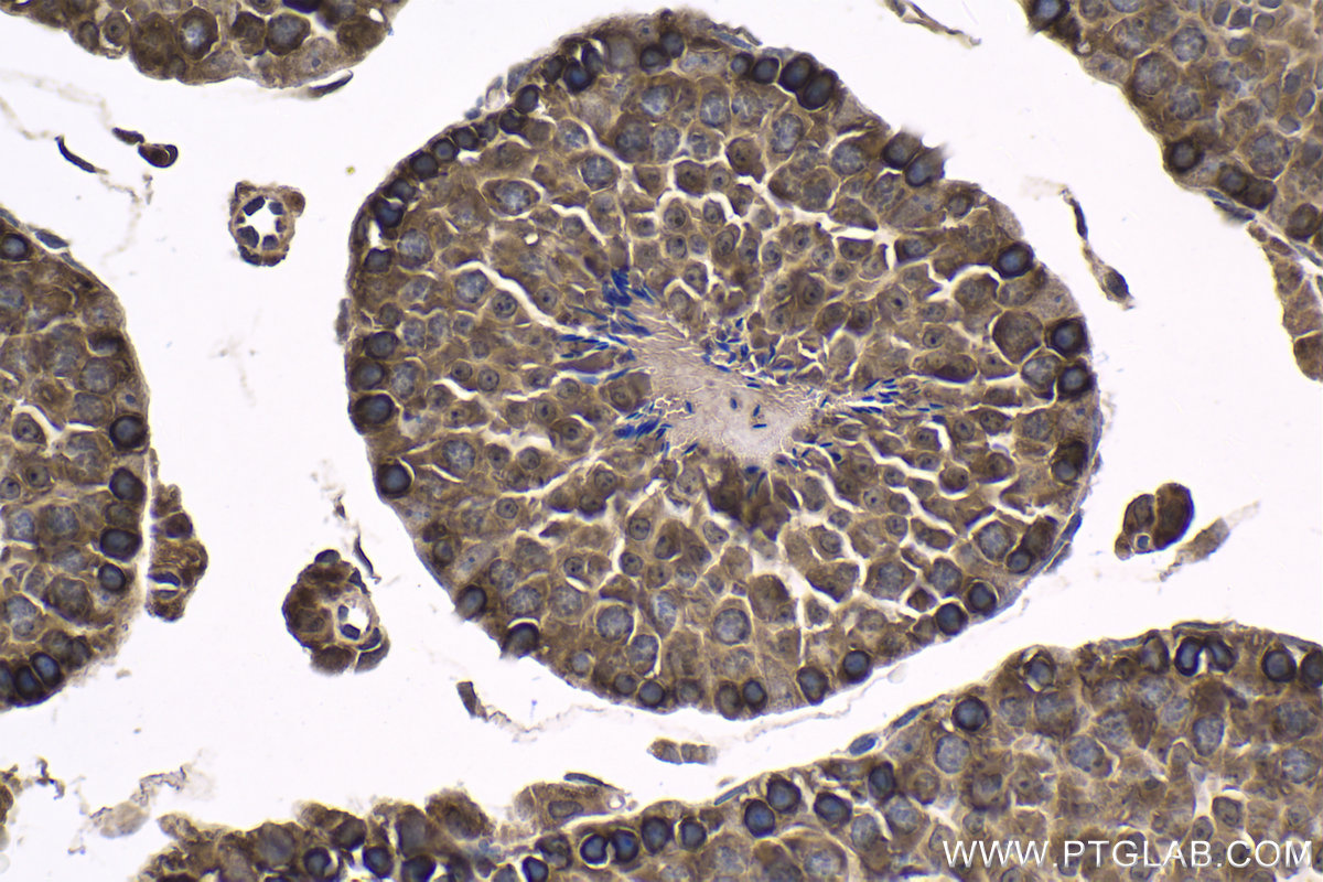 Immunohistochemical analysis of paraffin-embedded mouse testis tissue slide using KHC1667 (EWSR1/EWS IHC Kit).