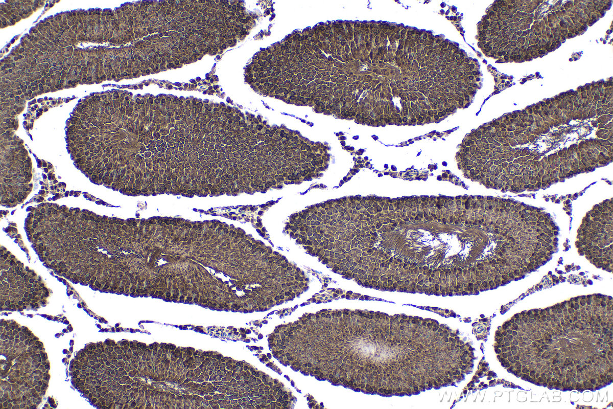 Immunohistochemical analysis of paraffin-embedded rat testis tissue slide using KHC1667 (EWSR1/EWS IHC Kit).