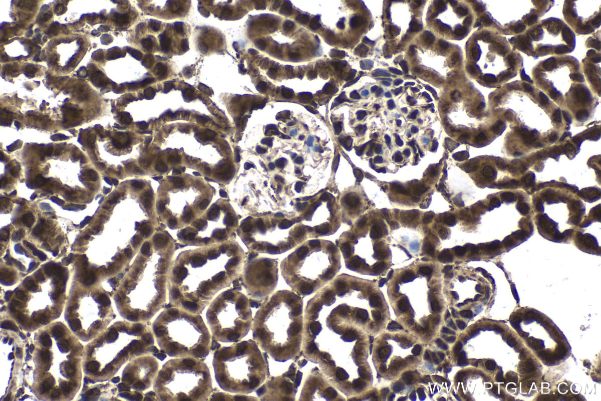 Immunohistochemical analysis of paraffin-embedded mouse kidney tissue slide using KHC1667 (EWSR1/EWS IHC Kit).