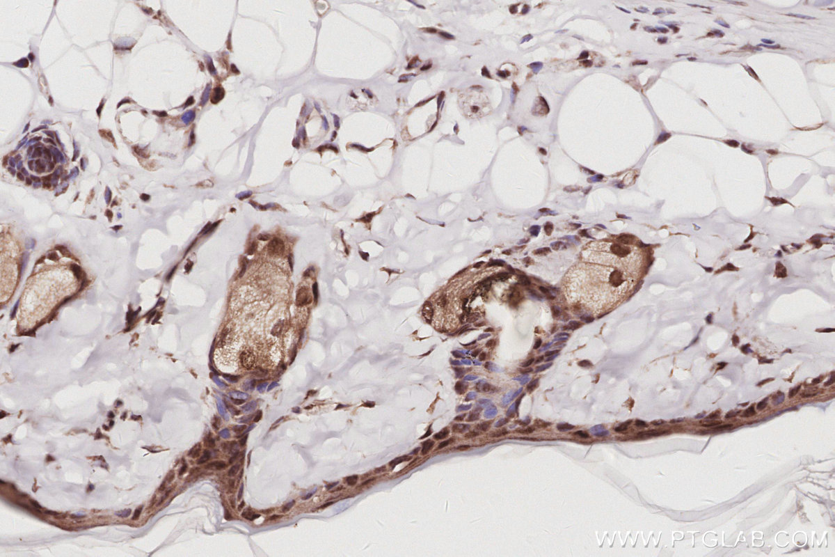 Immunohistochemical analysis of paraffin-embedded rat skin tissue slide using KHC3061 (EXOSC1 IHC Kit). Immunohistochemical analysis of paraffin-embedded rat skin tissue slide using KHC3061 (EXOSC1 IHC Kit).