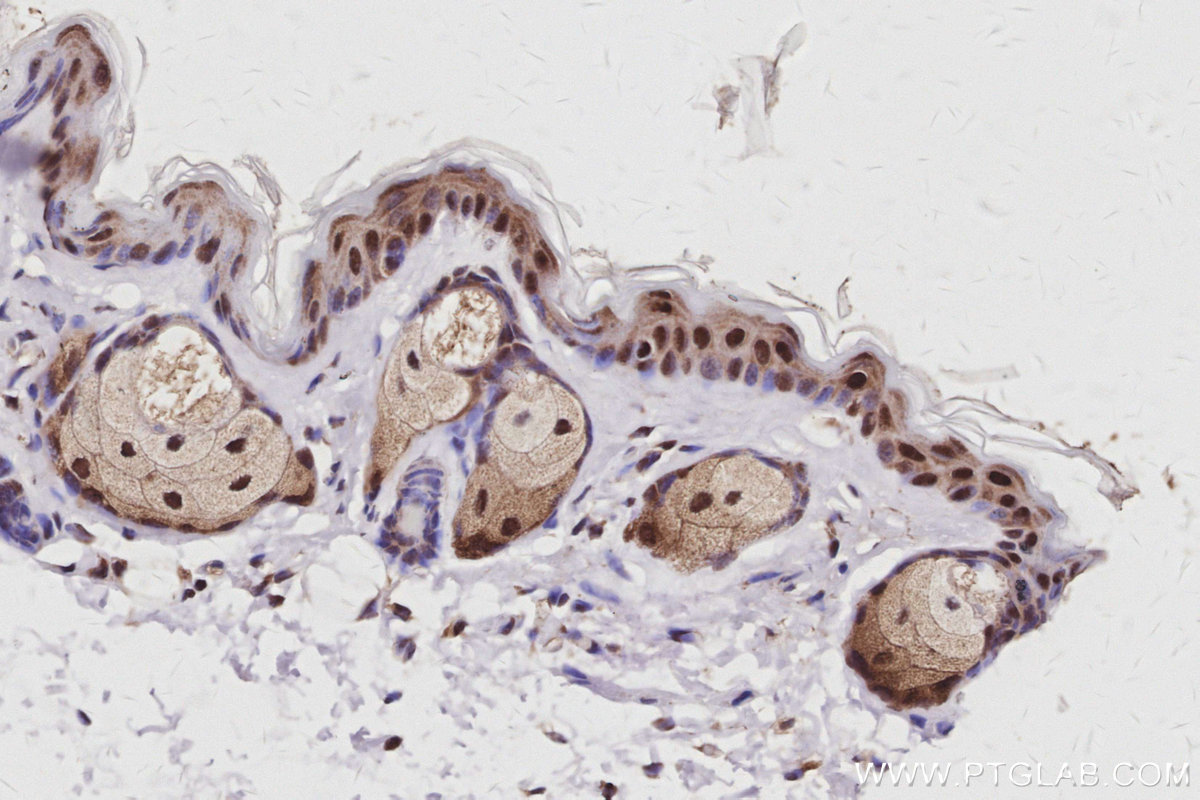 Immunohistochemical analysis of paraffin-embedded mouse skin tissue slide using KHC3061 (EXOSC1 IHC Kit). Immunohistochemical analysis of paraffin-embedded mouse skin tissue slide using KHC3061 (EXOSC1 IHC Kit).