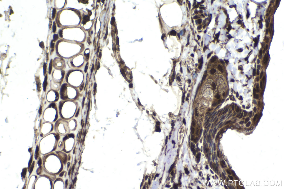 Immunohistochemical analysis of paraffin-embedded rat skin tissue slide using KHC1665 (EXOSC10 IHC Kit).