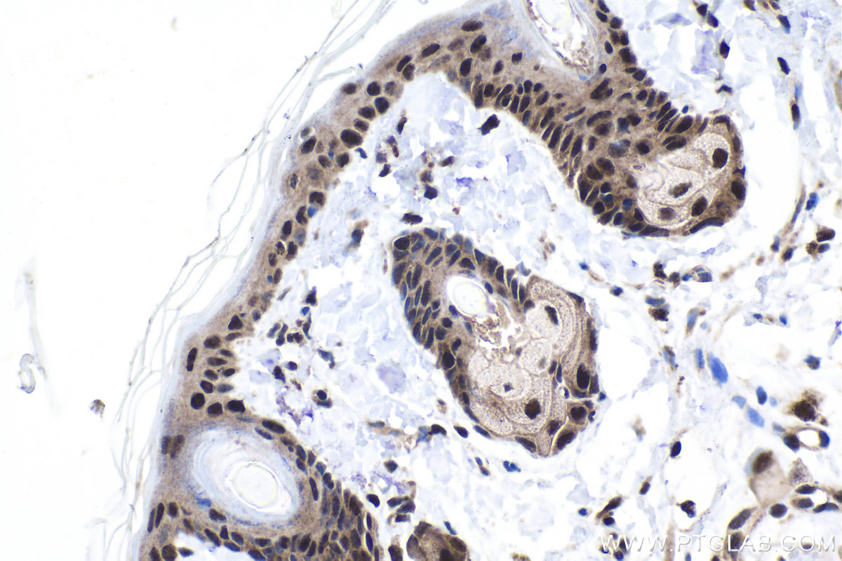 Immunohistochemical analysis of paraffin-embedded rat skin tissue slide using KHC1960 (EXOSC3 IHC Kit).