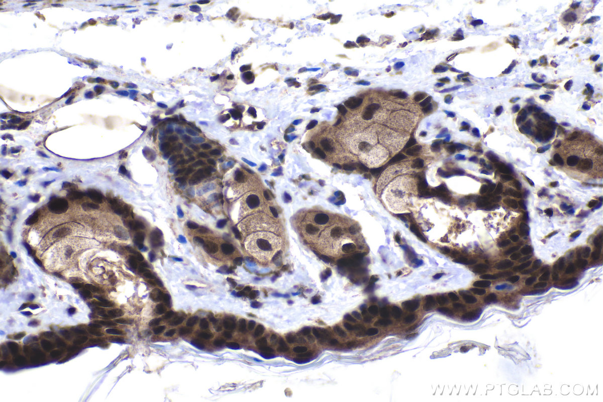 Immunohistochemical analysis of paraffin-embedded mouse skin tissue slide using KHC1960 (EXOSC3 IHC Kit).