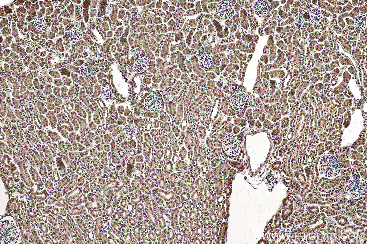 Immunohistochemical analysis of paraffin-embedded mouse kidney tissue slide using KHC0955 (EXOSC7 IHC Kit).