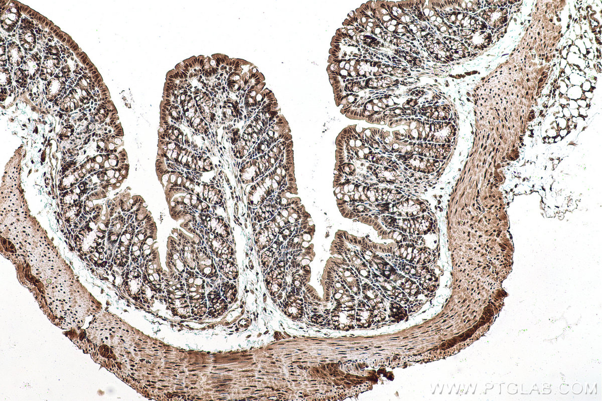 Immunohistochemical analysis of paraffin-embedded mouse colon tissue slide using KHC0955 (EXOSC7 IHC Kit).