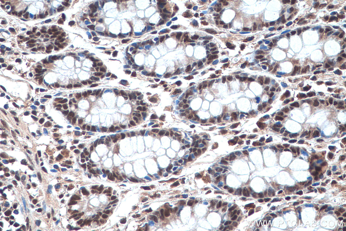 Immunohistochemical analysis of paraffin-embedded human colon tissue slide using KHC0955 (EXOSC7 IHC Kit).
