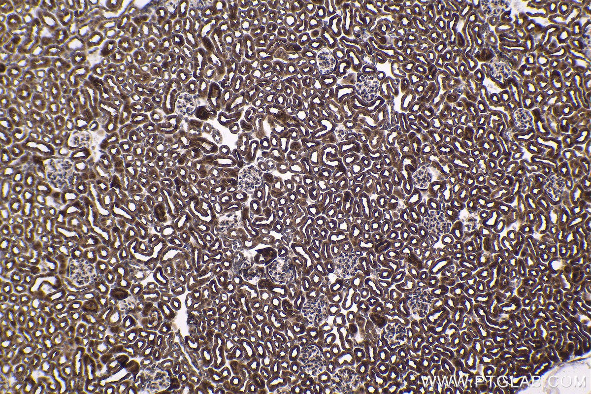 Immunohistochemical analysis of paraffin-embedded mouse kidney tissue slide using KHC1417 (EYA2 IHC Kit).
