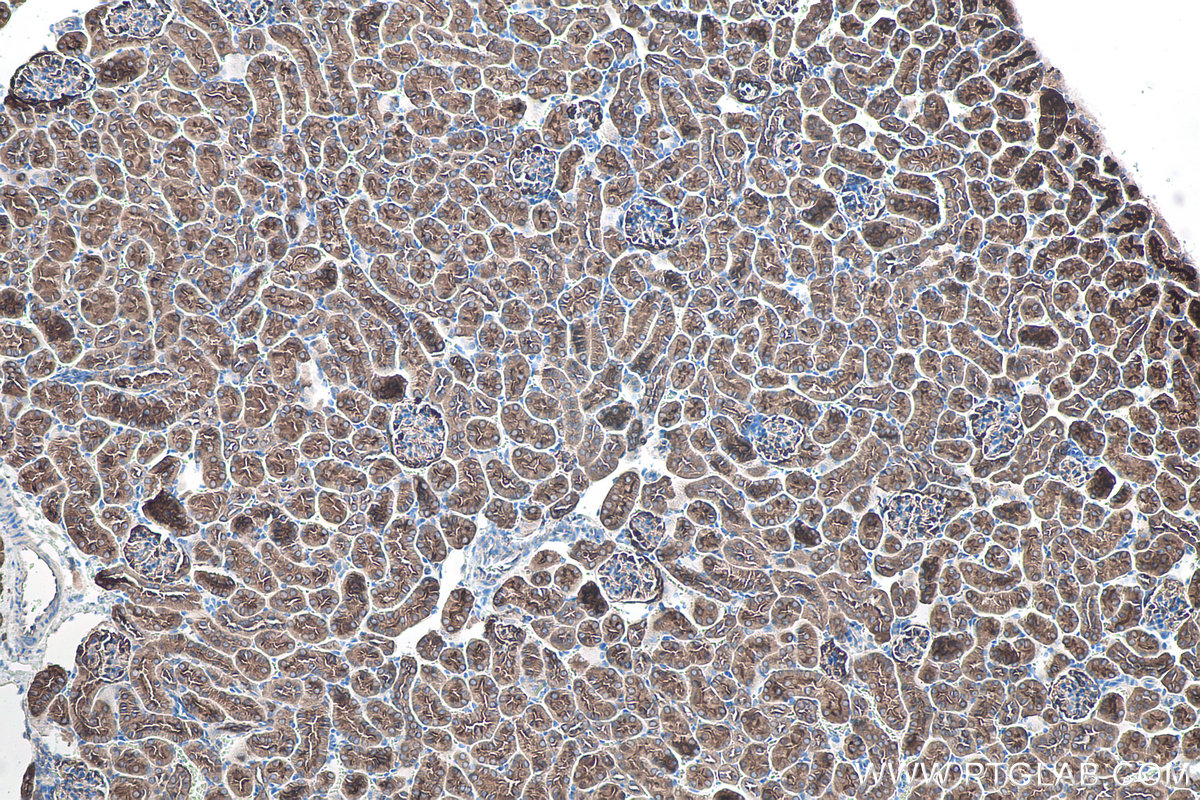 Immunohistochemical analysis of paraffin-embedded mouse kidney tissue slide using KHC0094 (Ezrin IHC Kit).