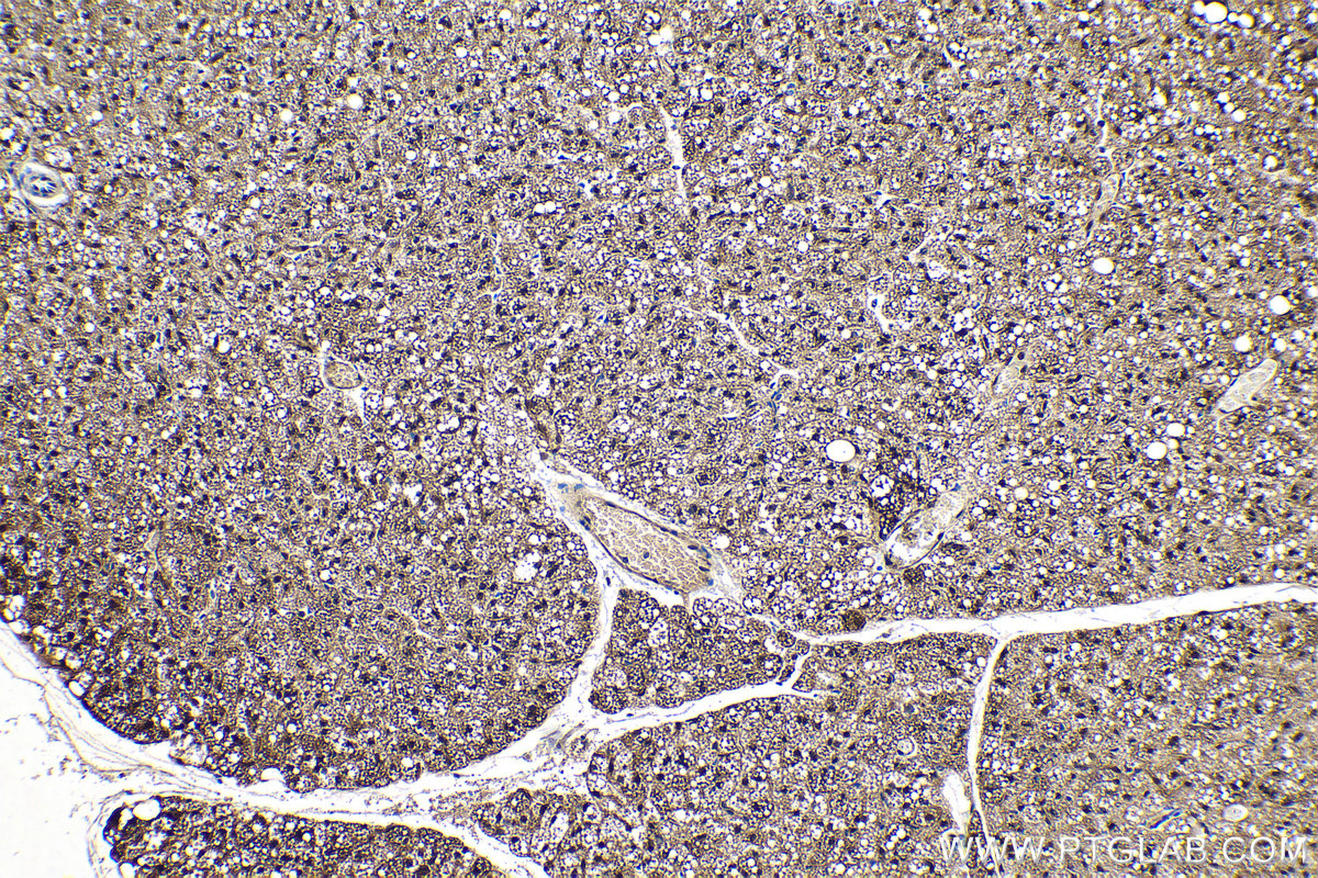 Immunohistochemical analysis of paraffin-embedded mouse brown adipose tissue slide using KHC0238 (FABP5 IHC Kit).