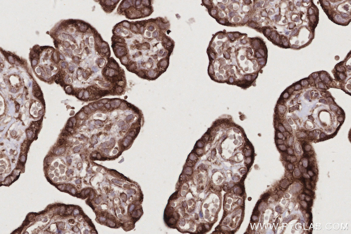 Immunohistochemical analysis of paraffin-embedded human placenta tissue slide using KHC2783 (FAF2 IHC Kit).
