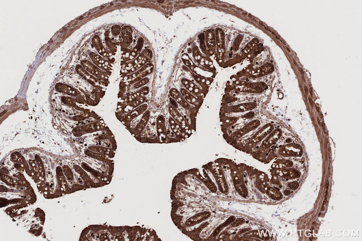 Immunohistochemical analysis of paraffin-embedded mouse colon tissue slide using KHC2783 (FAF2 IHC Kit).