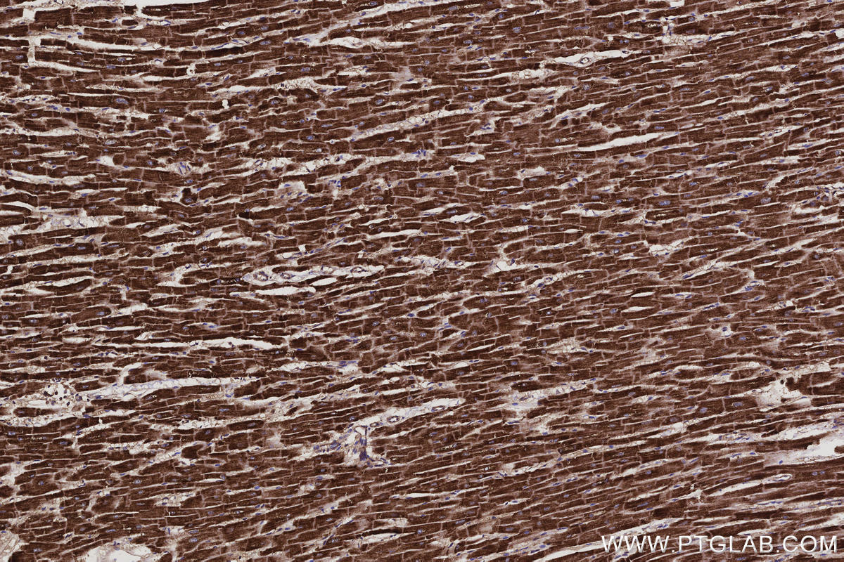 Immunohistochemical analysis of paraffin-embedded human heart tissue slide using KHC3099 (FAM13A IHC Kit).