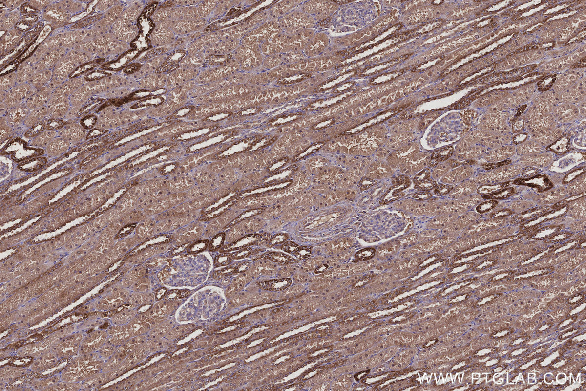 Immunohistochemical analysis of paraffin-embedded human kidney tissue slide using KHC3099 (FAM13A IHC Kit).