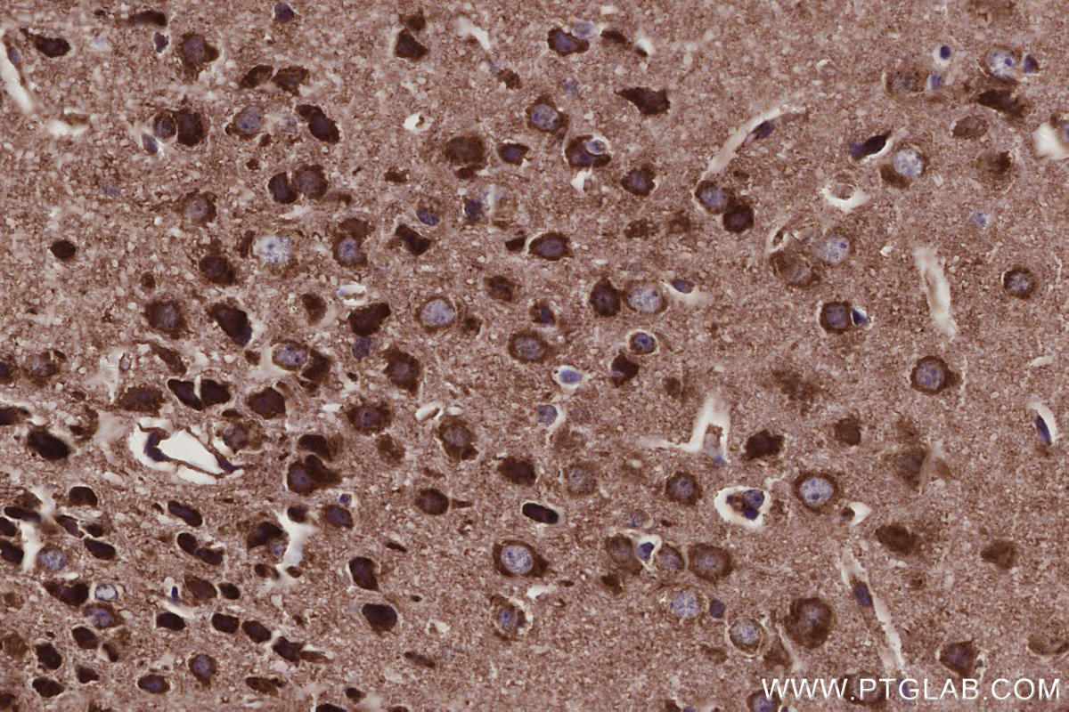 Immunohistochemical analysis of paraffin-embedded mouse brain tissue slide using KHC3099 (FAM13A IHC Kit).