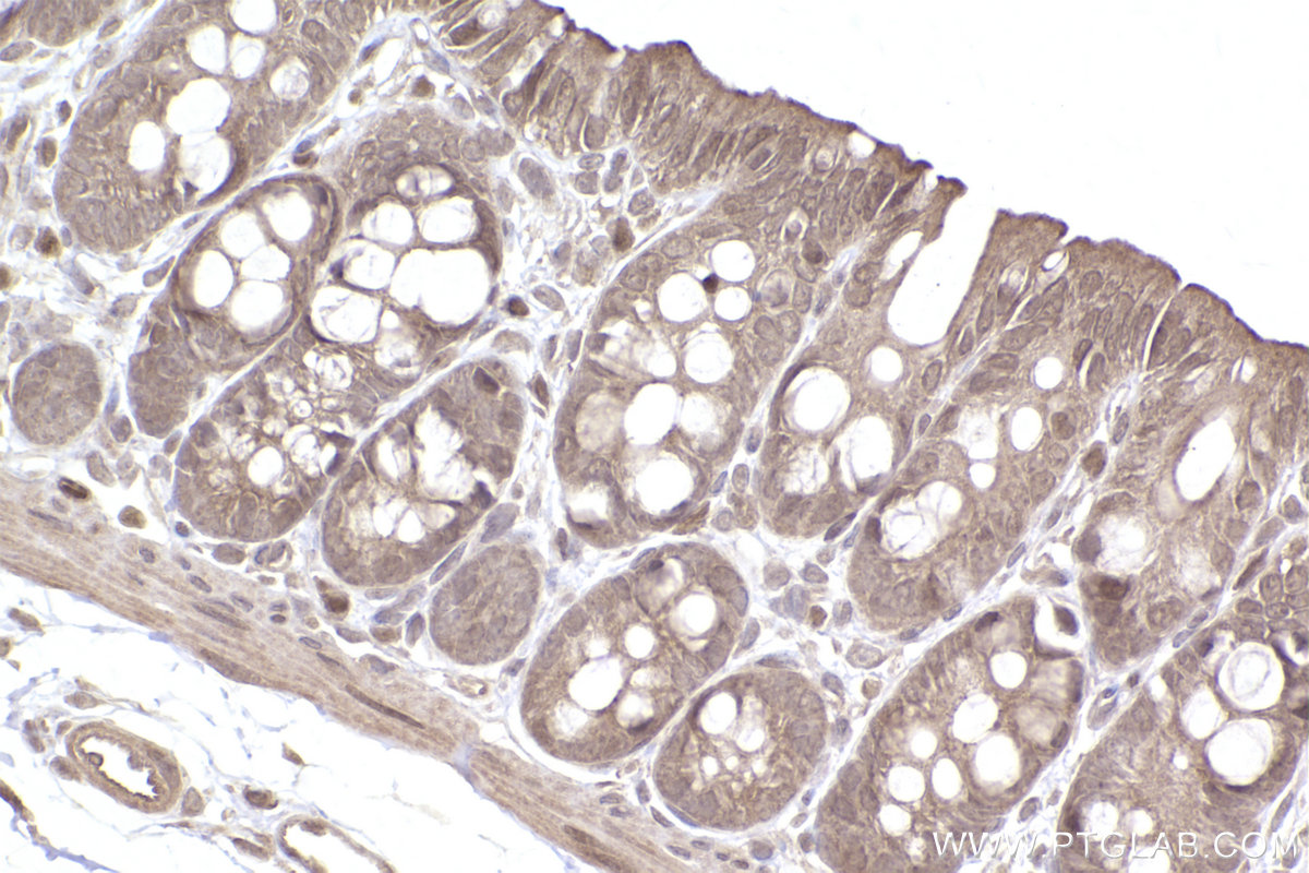 Immunohistochemical analysis of paraffin-embedded rat colon tissue slide using KHC2477 (FAM175B IHC Kit).