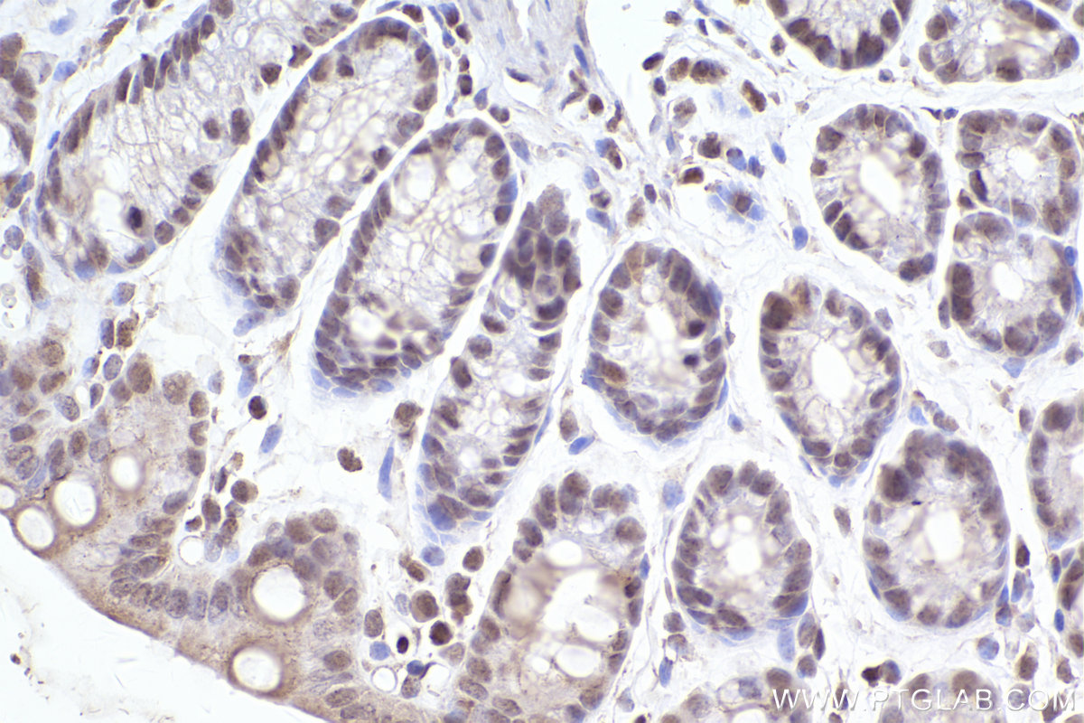 Immunohistochemical analysis of paraffin-embedded mouse colon tissue slide using KHC2477 (FAM175B IHC Kit).