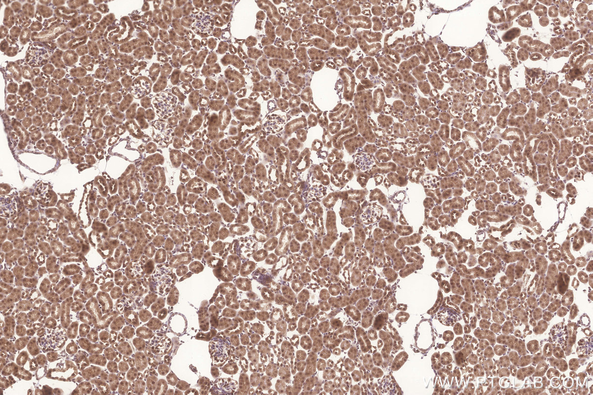 Immunohistochemical analysis of paraffin-embedded mouse kidney tissue slide using KHC3266 (FAM46C IHC Kit).