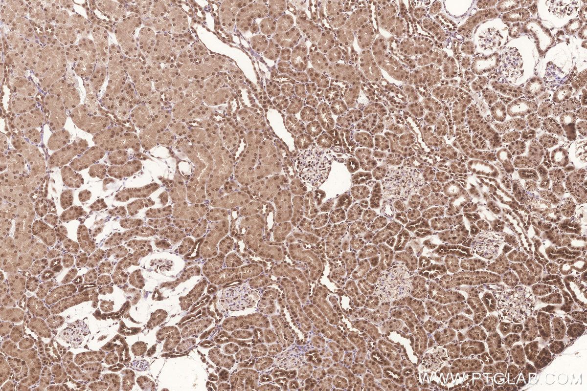 Immunohistochemical analysis of paraffin-embedded rat kidney tissue slide using KHC3266 (FAM46C IHC Kit).