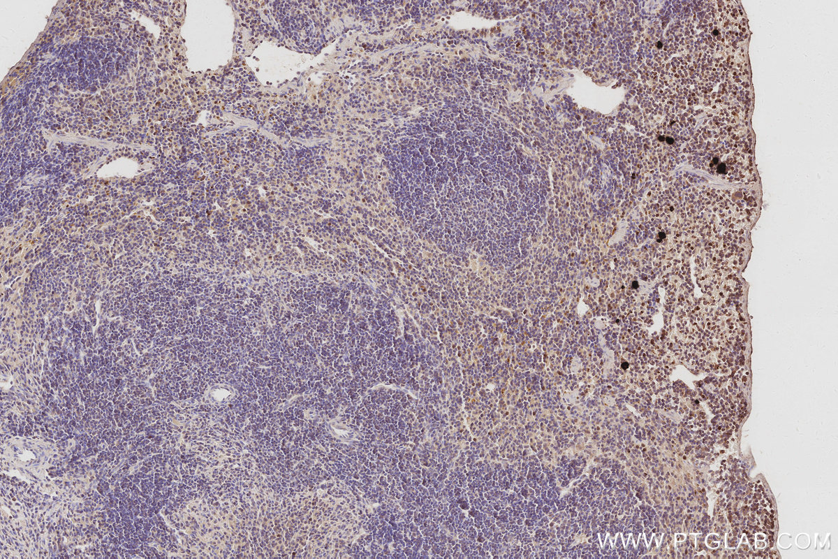Immunohistochemical analysis of paraffin-embedded mouse spleen tissue slide using KHC3073 (FAM65B IHC Kit). Immunohistochemical analysis of paraffin-embedded mouse spleen tissue slide using KHC3073 (FAM65B IHC Kit).