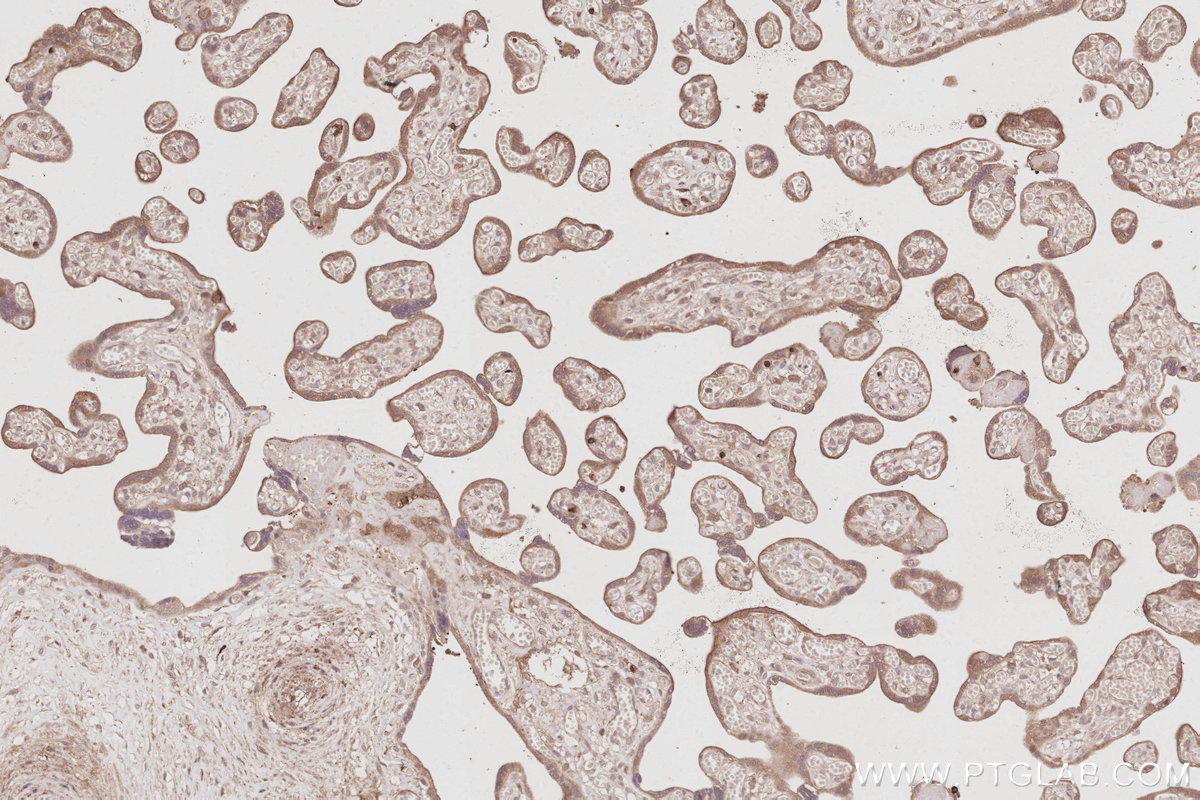 Immunohistochemical analysis of paraffin-embedded human placenta tissue slide using KHC3073 (FAM65B IHC Kit). Immunohistochemical analysis of paraffin-embedded human placenta tissue slide using KHC3073 (FAM65B IHC Kit).
