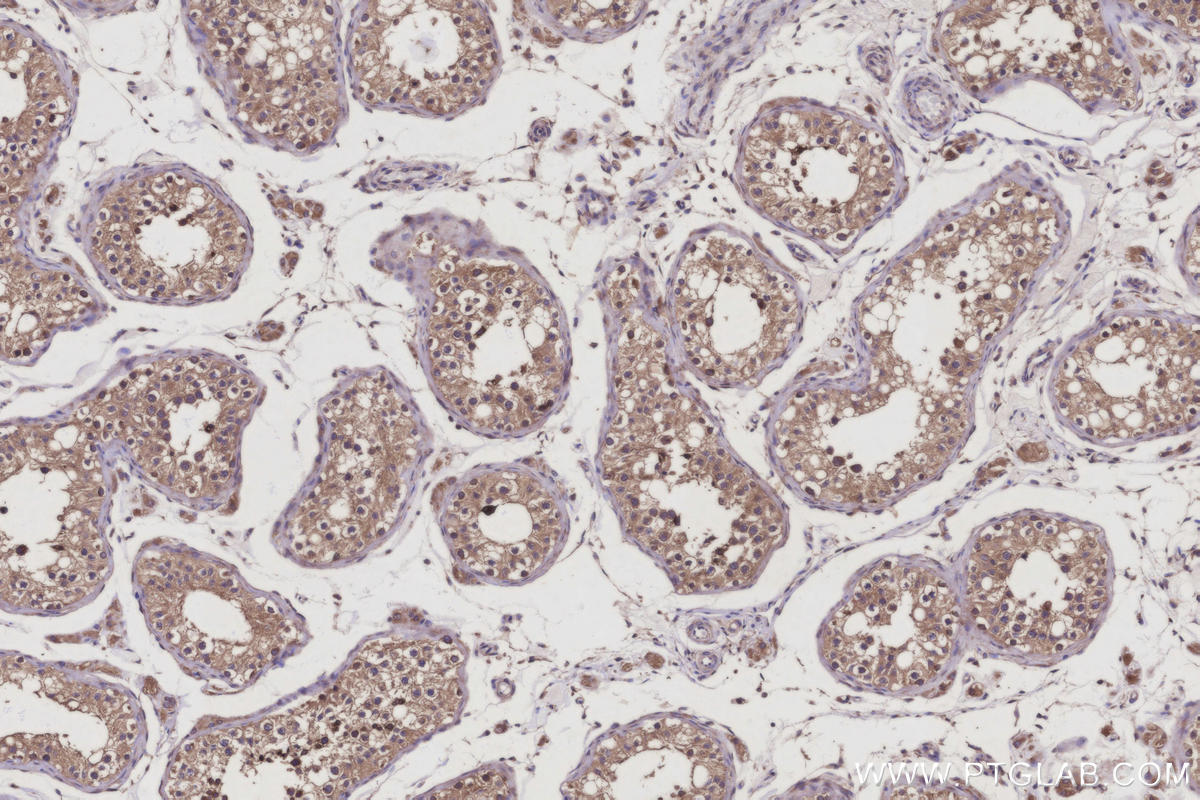 Immunohistochemical analysis of paraffin-embedded human testis tissue slide using KHC3123 (FAM8A1 IHC Kit).