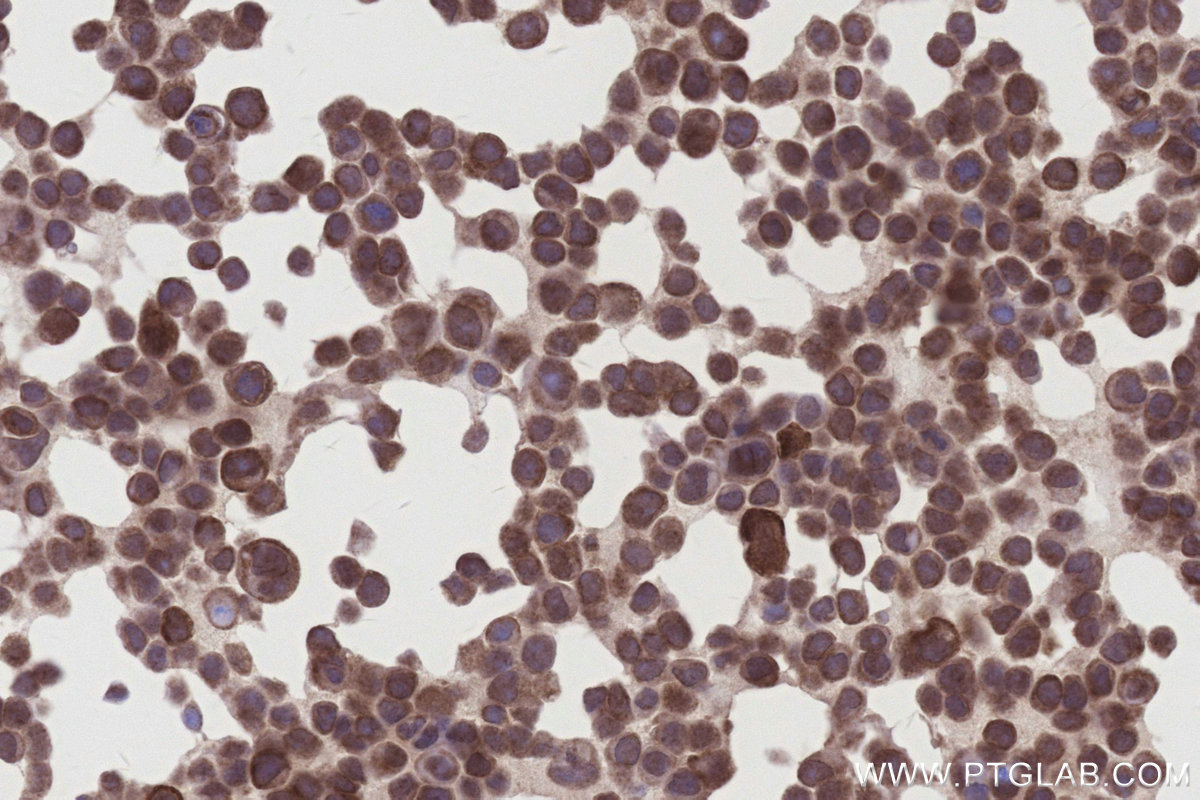 Immunohistochemical analysis of paraffin-embedded MCF-7 cells slide using KHC3123 (FAM8A1 IHC Kit).