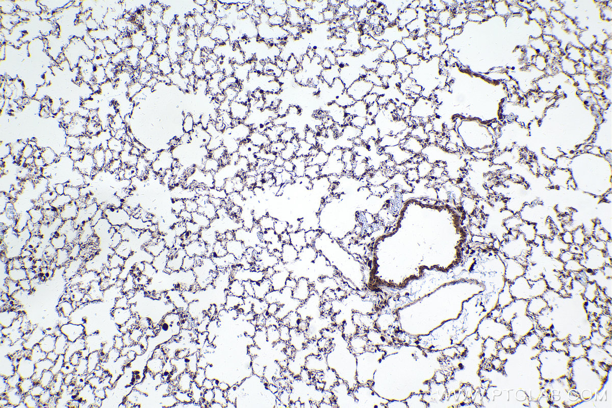 Immunohistochemical analysis of paraffin-embedded mouse lung tissue slide using KHC2409 (FAP IHC Kit).