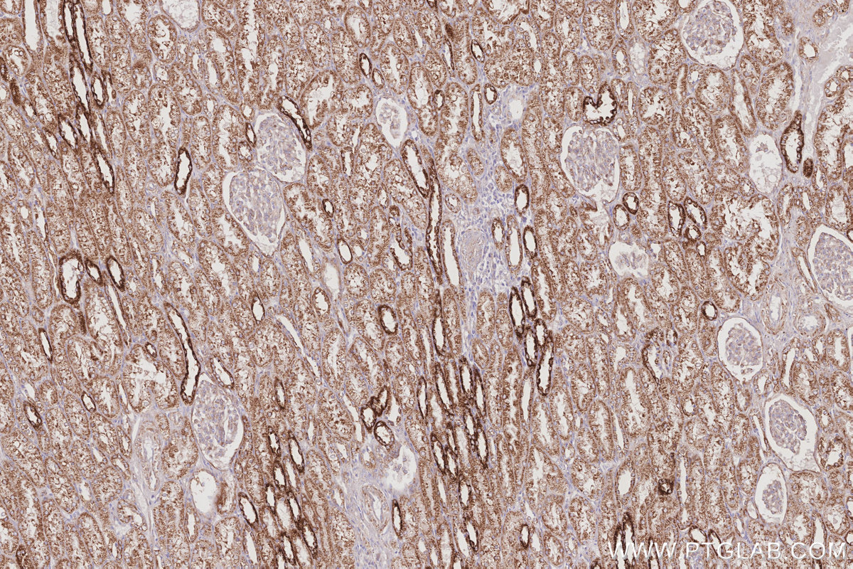 Immunohistochemical analysis of paraffin-embedded human kidney tissue slide using KHC3072 (FARP1 IHC Kit). Immunohistochemical analysis of paraffin-embedded human kidney tissue slide using KHC3072 (FARP1 IHC Kit).