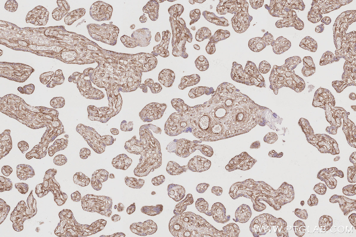 Immunohistochemical analysis of paraffin-embedded human placenta tissue slide using KHC3072 (FARP1 IHC Kit). Immunohistochemical analysis of paraffin-embedded human placenta tissue slide using KHC3072 (FARP1 IHC Kit).