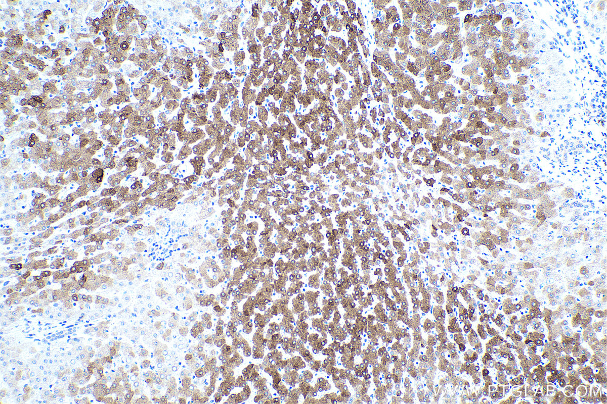 Immunohistochemical analysis of paraffin-embedded human liver tissue slide using KHC0416 (FARSB IHC Kit).