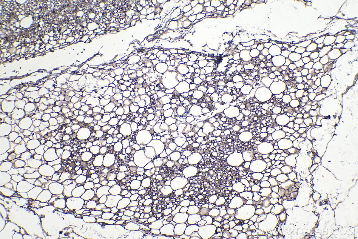 Immunohistochemical analysis of paraffin-embedded rat brown adipose tissue slide using KHC1103 (FASN IHC Kit).