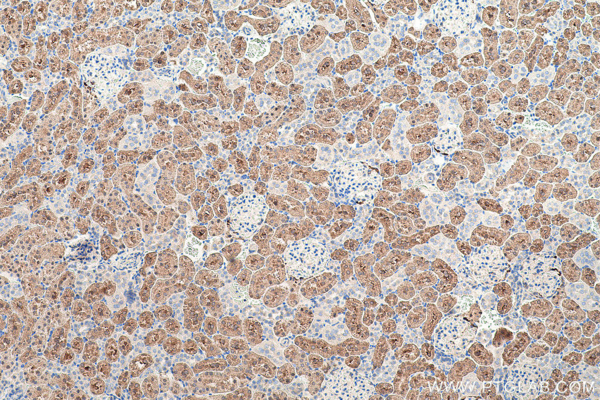 Immunohistochemical analysis of paraffin-embedded rat kidney tissue slide using KHC0526 (FBP1 IHC Kit).