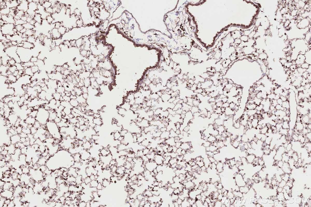 Immunohistochemical analysis of paraffin-embedded mouse lung tissue slide using KHC2830 (FBP17 IHC Kit).