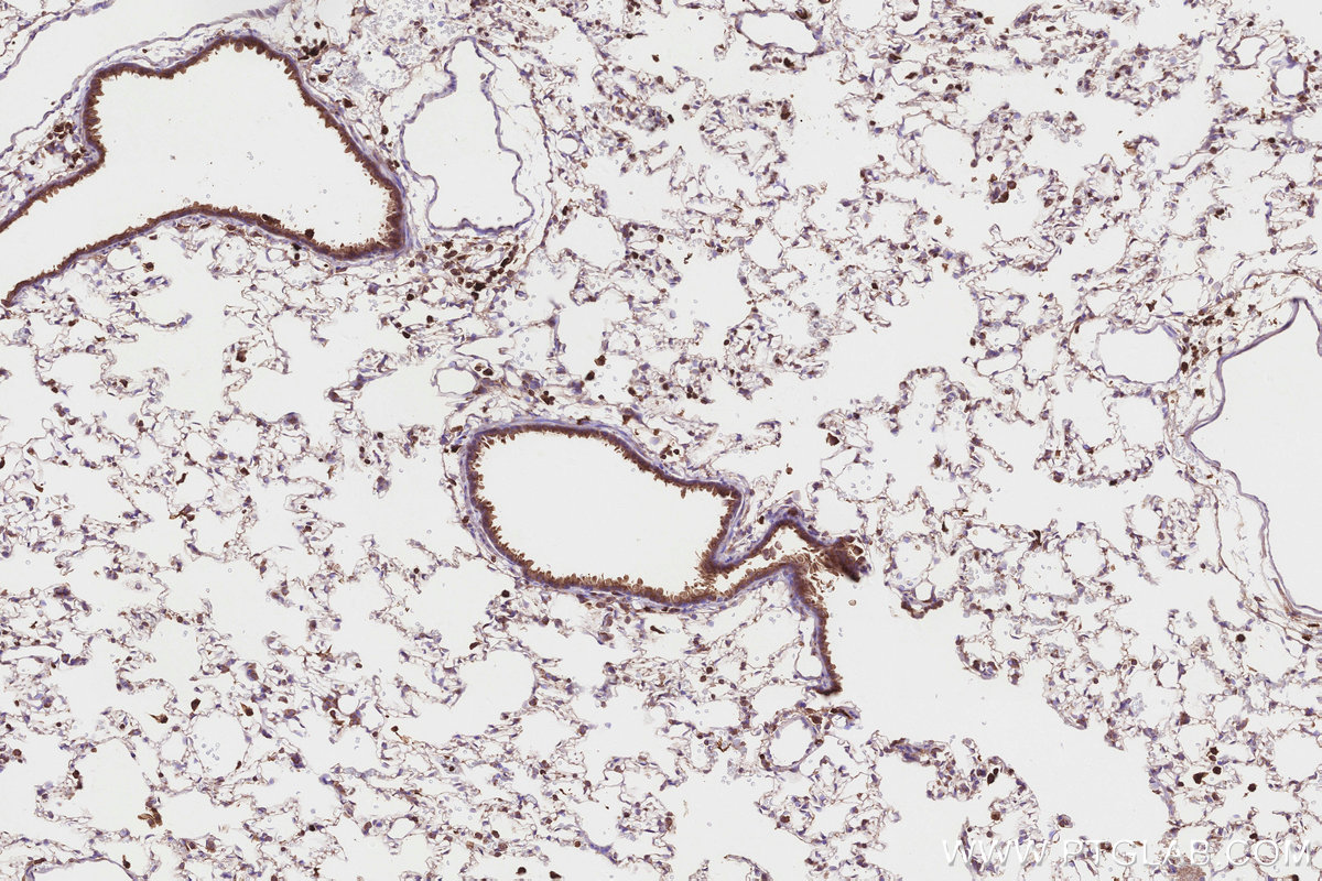 Immunohistochemical analysis of paraffin-embedded rat lung tissue slide using KHC2830 (FBP17 IHC Kit).