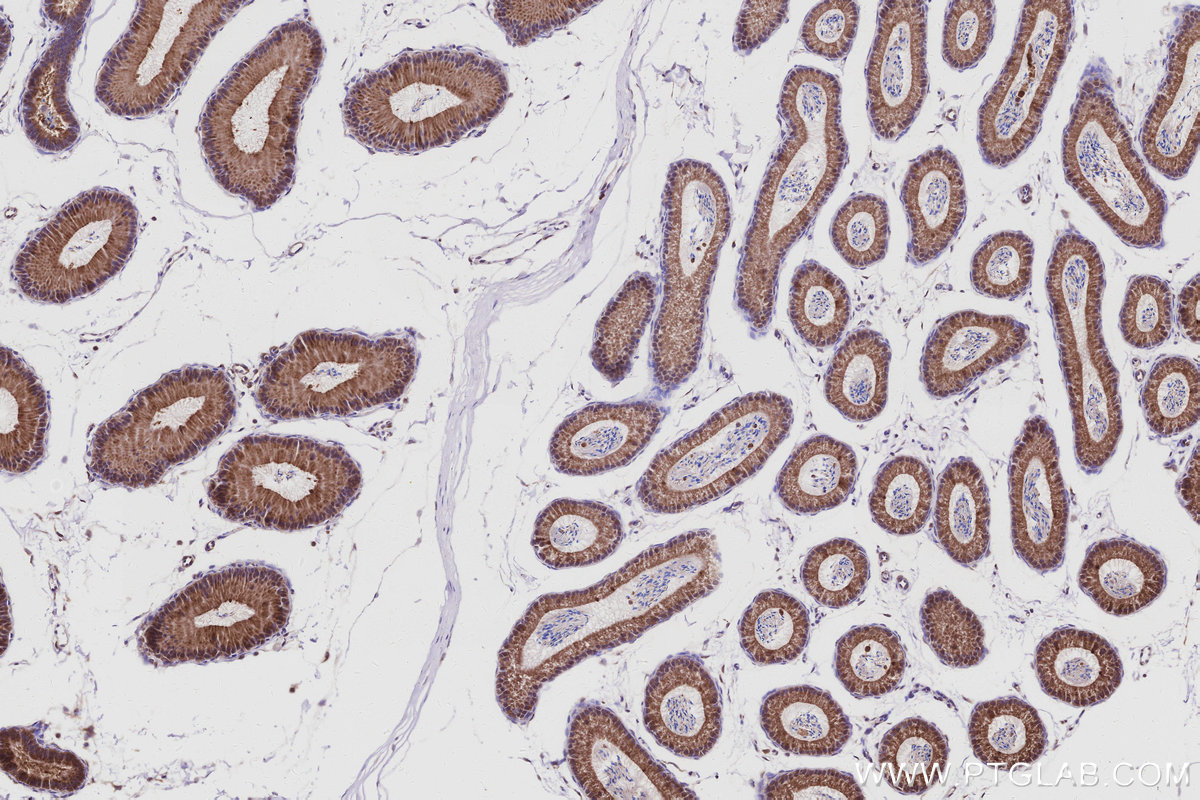 Immunohistochemical analysis of paraffin-embedded mouse epididymis tissue slide using KHC3029 (FBX4 IHC Kit).