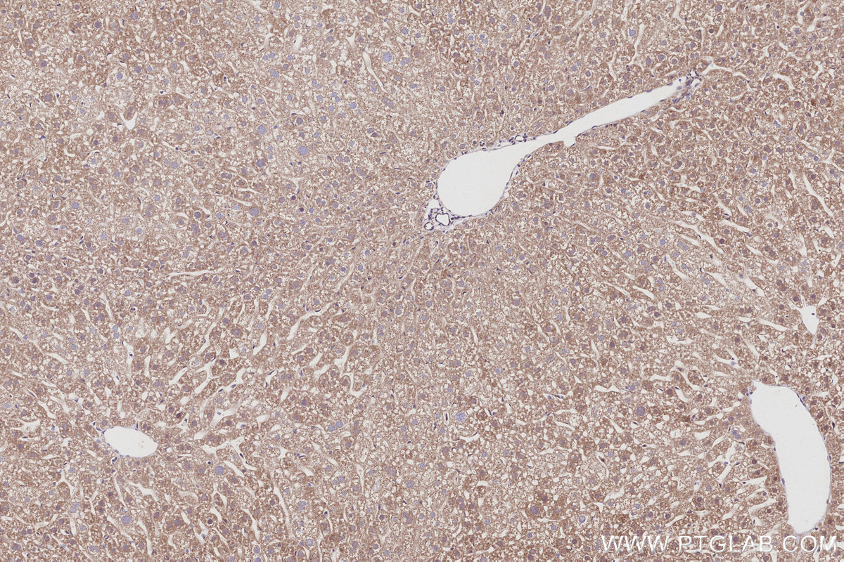 Immunohistochemical analysis of paraffin-embedded mouse liver tissue slide using KHC3029 (FBX4 IHC Kit).