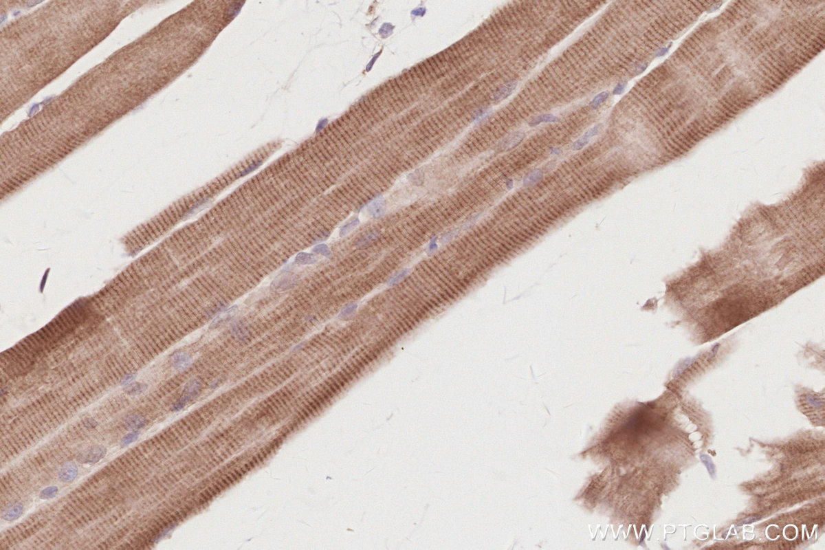 Immunohistochemical analysis of paraffin-embedded mouse skeletal muscle tissue slide using KHC2915 (FBXL15 IHC Kit).