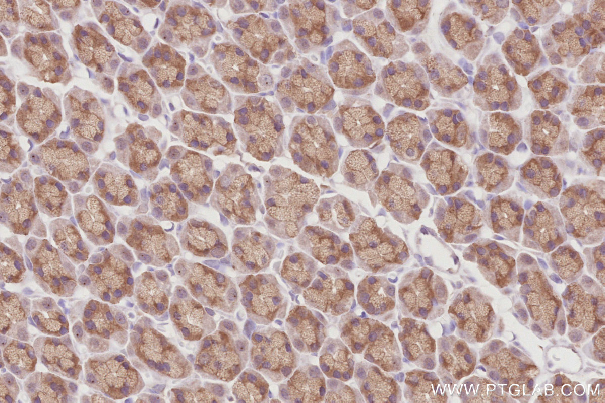 Immunohistochemical analysis of paraffin-embedded rat stomach tissue slide using KHC2915 (FBXL15 IHC Kit).