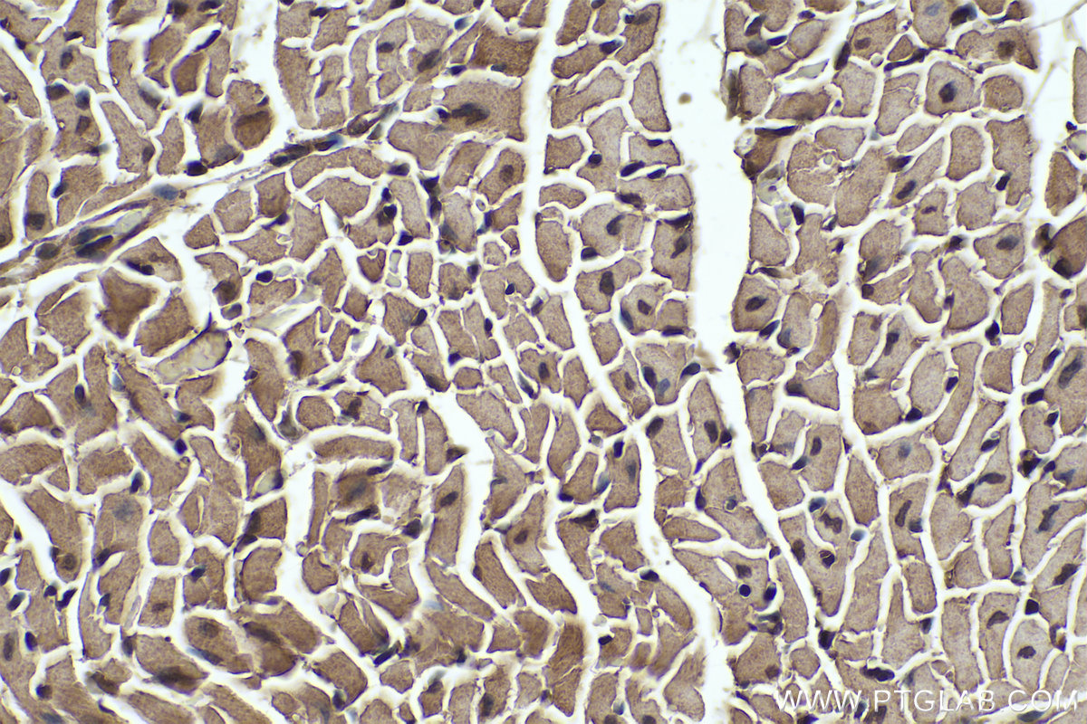 Immunohistochemical analysis of paraffin-embedded mouse heart tissue slide using KHC0329 (FBXO32 IHC Kit).